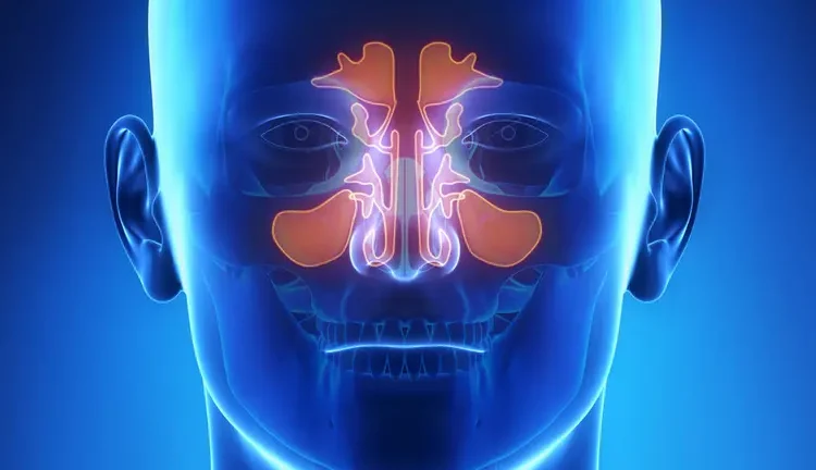 Top Causes of Chronic Sinusitis in American Adults
