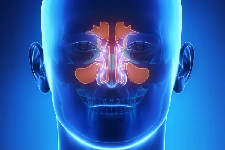 Top Causes of Chronic Sinusitis in American Adults
