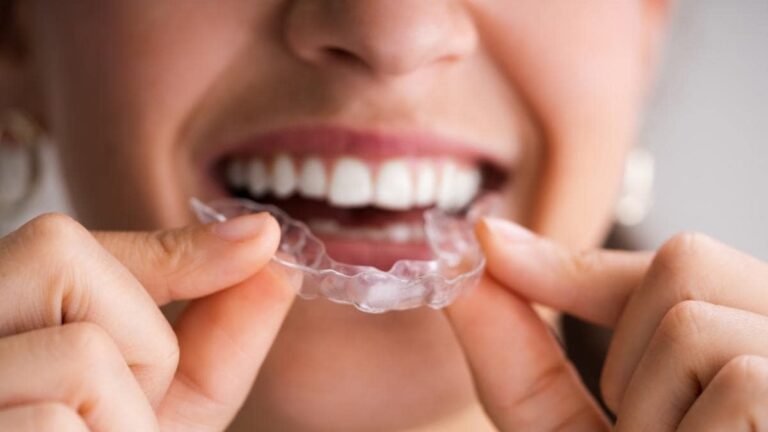 Dental Night Guards Laboratory for Better Patient Care