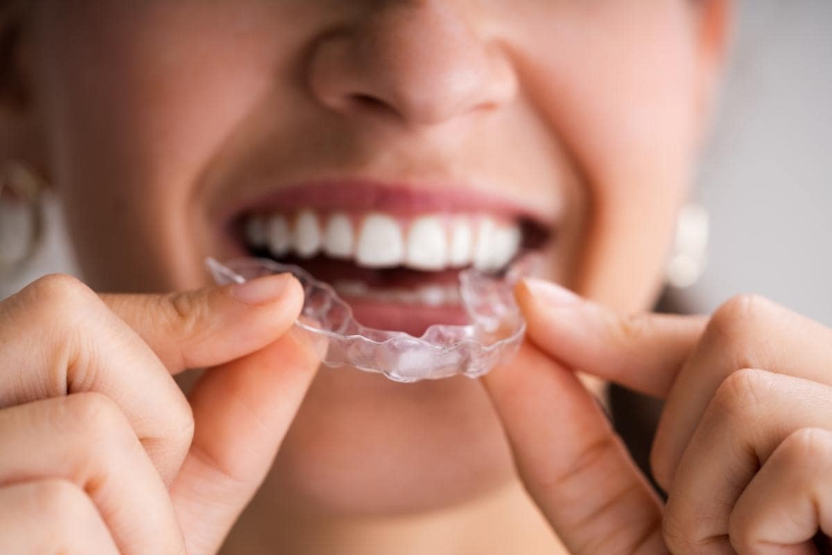 Dental Night Guards Laboratory for Better Patient Care